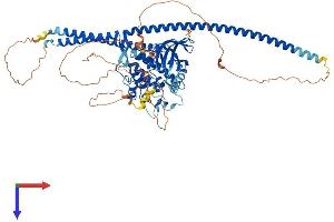 TLK1 Protein (AA 1-766) (His tag)