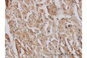 Immunoperoxidase of monoclonal antibody to EIF4G2 on formalin-fixed paraffin-embedded human heart. (EIF4G2 antibody  (AA 811-889))