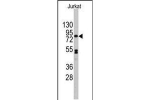 Western blot analysis of anti-CDH12 Antibody in Jurkat cell line lysates (35ug/lane). (Cadherin 12 antibody  (N-Term))