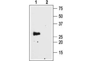 Western blot analysis of rat brain membranes:1.