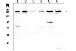 Western blot analysis of CPAMD8 using anti-CPAMD8 antibody (ABIN6719649). (CPAMD8 antibody  (AA 58-234))