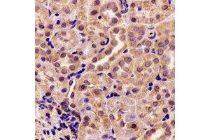 Immunohistochemical analysis of AK4 staining in rat kidney formalin fixed paraffin embedded tissue section. (AK4 antibody)