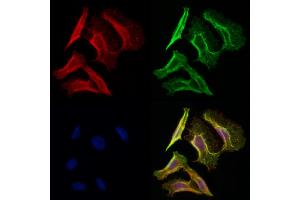 ABIN6258908 and ABIN6275622 staining Hela cells by IF/ICC. (CD1e antibody  (Internal Region))