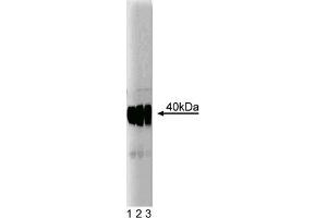 Western Blotting (WB) image for anti-Small Nuclear Ribonucleoprotein Polypeptide N (SNRPN) (AA 14-174) antibody (ABIN968086) (SNRPN antibody  (AA 14-174))