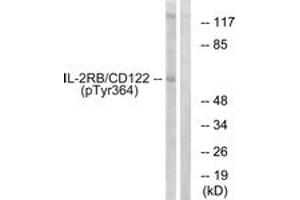 Western blot analysis of extracts from COS7 cells, using IL-2R beta/CD122 (Phospho-Tyr364) Antibody.