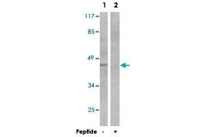 Western blot analysis of extracts from COLO 205 cells, using ACTG2 polyclonal antibody . (ACTG2 antibody)