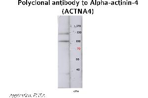 Image no. 1 for anti-Actinin, alpha 4 (ACTN4) (N-Term) antibody (ABIN347113) (alpha Actinin 4 antibody  (N-Term))