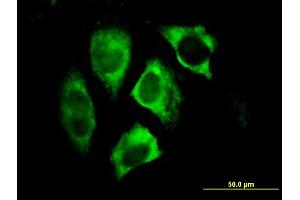 Immunofluorescence of monoclonal antibody to PARK2 on HeLa cell.