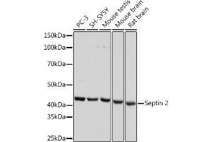 Western blot analysis of extracts of various cell lines, using Septin 2 Rabbit mAb (ABIN7270203) at 1:1000 dilution. (Septin 2 antibody)