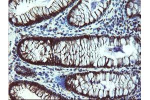 Immunohistochemical staining of paraffin-embedded Human colon tissue using anti-TBCC mouse monoclonal antibody.