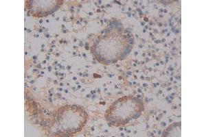 Used in DAB staining on fromalin fixed paraffin- embedded Kidney tissue (ABCA12 antibody  (AA 1346-1577))