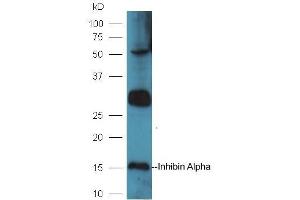 Mouse intestinal lysates probed with Rabbit Anti-Inhibin Alpha Polyclonal Antibody, Unconjugated (ABIN1715125) at 1:300 in 4˚C. (Inhibin alpha antibody  (AA 281-366))