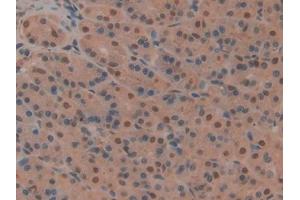 IHC-P analysis of Rat Stomach Tissue, with DAB staining. (CD2AP antibody  (AA 368-623))