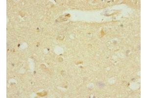 Immunohistochemistry of paraffin-embedded human brain tissue using ABIN7150519 at dilution of 1:100 (DNAJB2 antibody  (AA 215-324))
