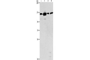 Western Blotting (WB) image for anti-PTK2 Protein tyrosine Kinase 2 (PTK2) antibody (ABIN2422853) (FAK antibody)
