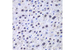 Immunohistochemistry of paraffin-embedded human liver injury using APEX1 antibody at dilution of 1:100 (400x lens). (APEX1 antibody)