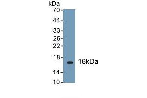 Detection of Recombinant GLP1R, Human using Polyclonal Antibody to Glucagon Like Peptide 1 Receptor (GLP1R) (GLP1R antibody  (AA 24-139))