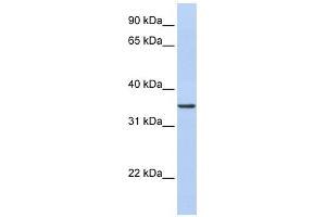 CDC42EP4 antibody used at 1 ug/ml to detect target protein. (CDC42EP4 antibody)