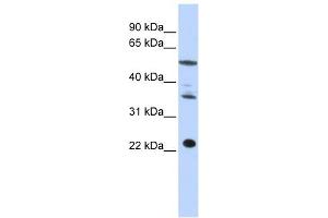 CENPM antibody used at 1 ug/ml to detect target protein. (CENPM antibody  (Middle Region))