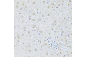 Immunohistochemistry of paraffin-embedded rat liver using SIRT1 antibody (ABIN6291361) at dilution of 1:100 (40x lens). (SIRT1 antibody)