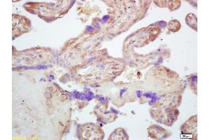Formalin-fixed and paraffin embedded human placenta labeled with Rabbit Anti CARD4 Polyclonal Antibody, Unconjugated (ABIN872332) at 1:200 followed by conjugation to the secondary antibody and DAB staining (NOD1 antibody  (AA 51-150))