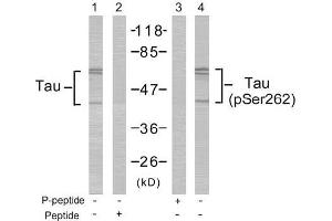 Image no. 2 for anti-Microtubule-Associated Protein tau (MAPT) (pSer262) antibody (ABIN196808) (MAPT antibody  (pSer262))