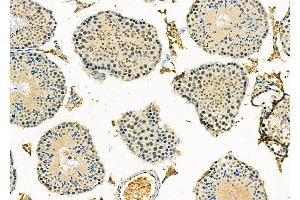 ABIN6265248 and ABIN6278995 at 1/100 staining Mouse testis tissue by IHC-P.