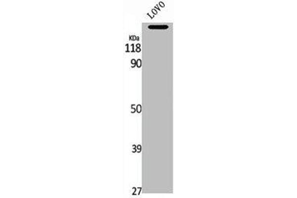 MADD antibody  (Internal Region)