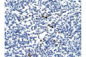 Image no. 1 for anti-T-Cell Acute Lymphocytic Leukemia 1 (TAL1) (AA 236-285) antibody (ABIN6735910) (TAL1 antibody  (AA 236-285))