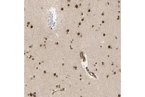 Immunohistochemical staining of human lateral ventricle with ZMYM6 polyclonal antibody  shows strong nuclear positivity in neuronal cells at 1:50-1:200 dilution.