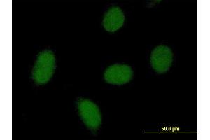 Immunofluorescence of purified MaxPab antibody to C9orf152 on HeLa cell.