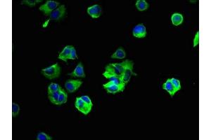 Immunofluorescent analysis of MCF-7 cells using ABIN7166350 at dilution of 1:100 and Alexa Fluor 488-congugated AffiniPure Goat Anti-Rabbit IgG(H+L) (YIPF6 antibody  (AA 2-84))