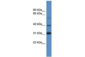 WB Suggested Anti-SOX1 Antibody Titration: 1. (SOX1 antibody  (C-Term))
