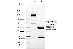 SDS-PAGE Analysis Purified CD11b Mouse Monoclonal Antibody (ITGAM/3337). (CD11b antibody  (AA 941-1074))