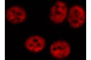 ABIN6267348 staining HeLa cells by IF/ICC. (MYB antibody  (pSer532))