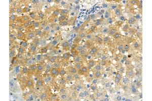 Phospho-RON (Ser1394) Antibody at 1/100 staining Rat liver tissue by IHC-P.