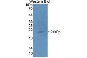 Western blot analysis of the recombinant protein. (ICAM-3/CD50 antibody  (AA 46-197))
