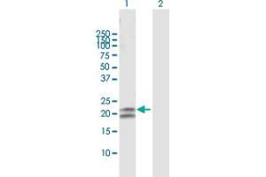 Western Blot analysis of CEACAM21 expression in transfected 293T cell line by CEACAM21 MaxPab polyclonal antibody. (CEACAM21 antibody  (AA 1-191))