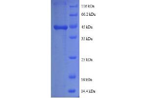 SDS-PAGE (SDS) image for Prefoldin Subunit 5 (PFDN5) (AA 2-154), (full length) protein (GST tag) (ABIN7479601) (PFDN5 Protein (AA 2-154, full length) (GST tag))
