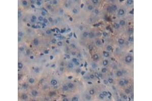 IHC-P analysis of Rat Tissue, with DAB staining. (PCSK9 antibody  (AA 164-428))