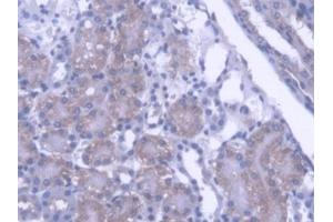 DAB staining on IHC-P; Samples: Mouse Kidney Tissue (PTPN21 antibody  (AA 983-1176))