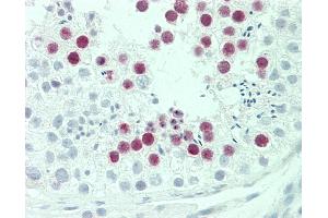 Anti-SYCE2 antibody IHC staining of human testis. (SYCE2 antibody  (AA 1-30))