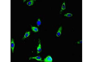 Immunofluorescent analysis of Hela cells using ABIN7144308 at dilution of 1:100 and Alexa Fluor 488-congugated AffiniPure Goat Anti-Rabbit IgG(H+L) (Anoctamin 4 antibody  (AA 1-200))