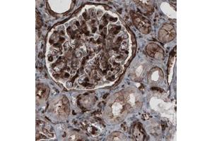 Immunohistochemical staining (Formalin-fixed paraffin-embedded sections) of human kidney with ZYX monoclonal antibody, clone CL2502  shows strong membranous and moderate cytoplasmic immunoreactivity in renal glomeruli and tubule. (ZYX antibody)
