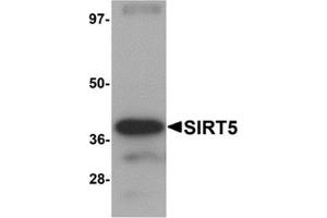 Western blot analysis of SIRT5 in human liver tissue lysate with SIRT5 antibody at 1 μg/ml.