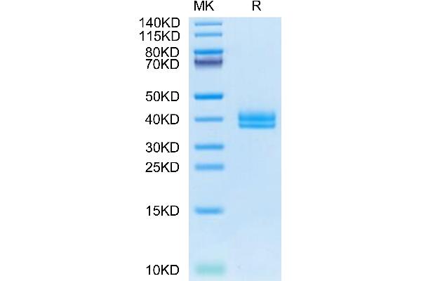 IGFBP2 Protein (AA 33-325) (His tag)