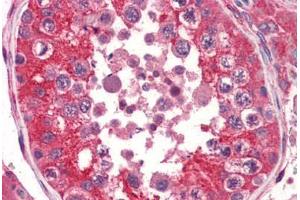 Human Testis (formalin-fixed, paraffin-embedded) stained with EPHA2 antibody ABIN364396 at 5 ug/ml followed by biotinylated anti-mouse IgG secondary antibody ABIN481714, alkaline phosphatase-streptavidin and chromogen. (EPH Receptor A2 antibody  (AA 559-976))