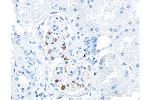Immunohistochemistry (IHC) image for anti-Tight Junction Protein 1 (TJP1) (AA 650-700) antibody (ABIN7453989) (Recombinant TJP1 antibody  (AA 650-700))