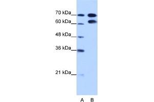WB Suggested Anti-RAVER1 Antibody Titration:  1. (RAVER1 antibody  (N-Term))