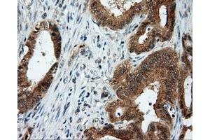 Immunohistochemical staining of paraffin-embedded Kidney tissue using anti-LIPG mouse monoclonal antibody. (LIPG antibody)